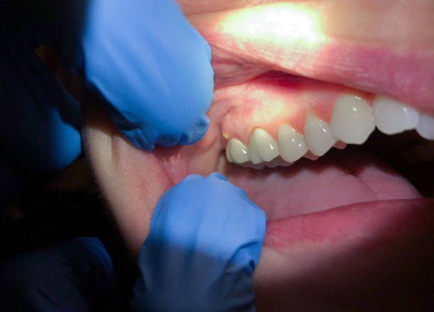 Best Emergency Dental Care for Broken or Chipped Teeth in Alma, AR