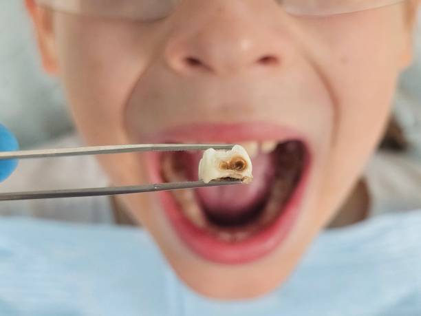 Best Emergency Root Canal Treatment in Alma, AR